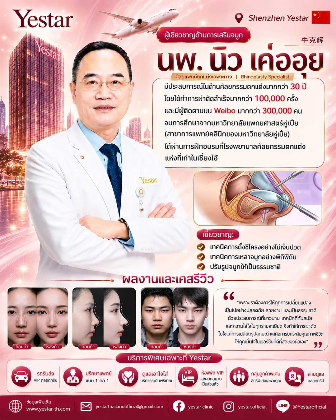 Dr. หนิว เค่อฮุย Natural Rhinoplasty